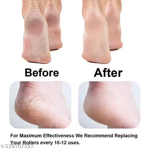 JAYLAA Pedicure Tool – Electric Foot Roller Callus Remover