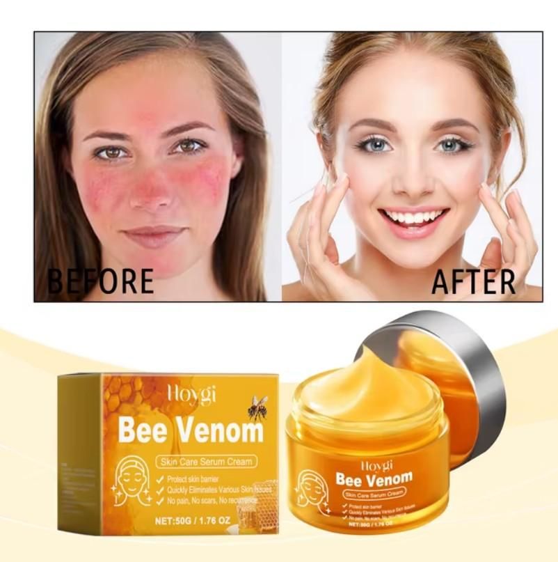 Bee Venom Skin Cream 100ml Each (Pack of 2) - NuroHub